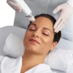 potenza microneedling